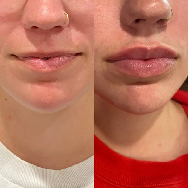 Before and After Result 1