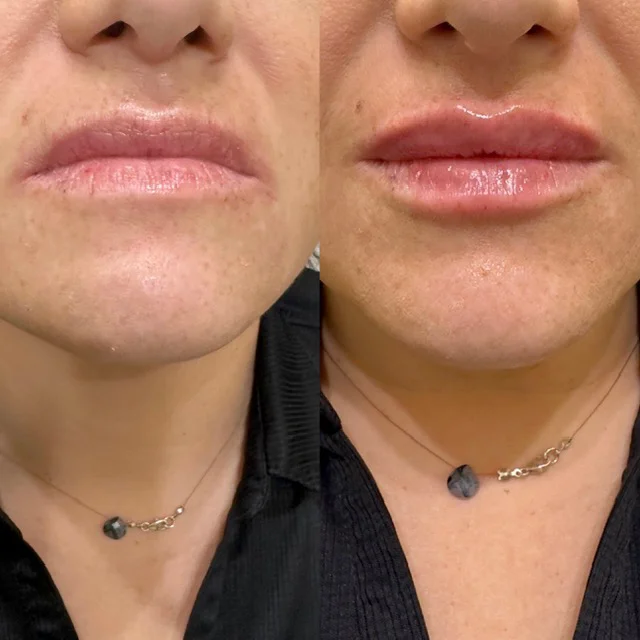 Before and After Result 2