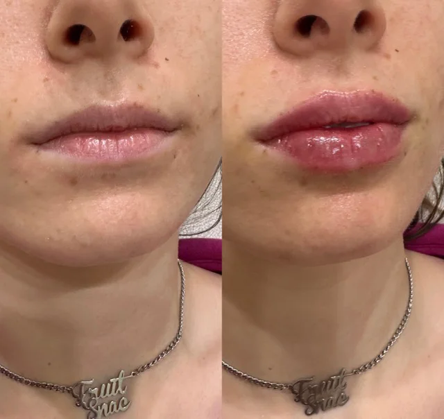 Before and After Result 5