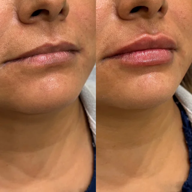 Before and After Result 7