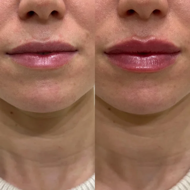 Before and After Result 8